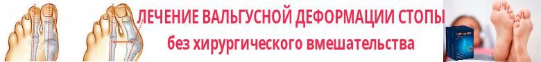 Феху - руна багатства, щастя і удачі