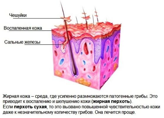 види лупи як їх розрізнити