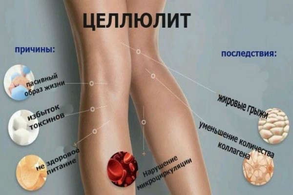 як прибрати целюліт з ляшек і сідниць в домашніх умовах швидко