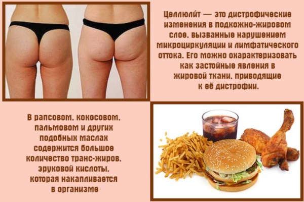 як прибрати целюліт з ляшек і сідниць в домашніх умовах за тиждень