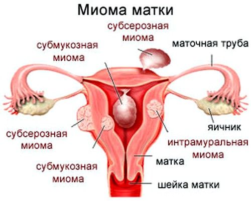 Молитва при міомі для зцілення