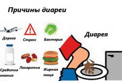 причини діареї