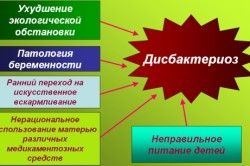 дисбактеріоз кишечника