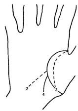 Що означають горби пальців
