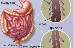 діарея