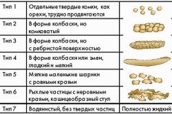 типи дефекації