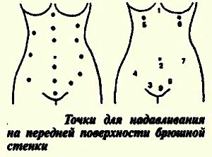 точки